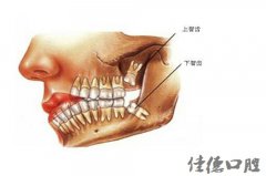 合肥的口腔医院拔智齿多少钱—谁有好牙科建议？