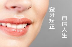 合肥牙齿正畸大概需要多少钱？
