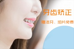 合肥牙齿矫正的费用是多少-美齿笑常开？