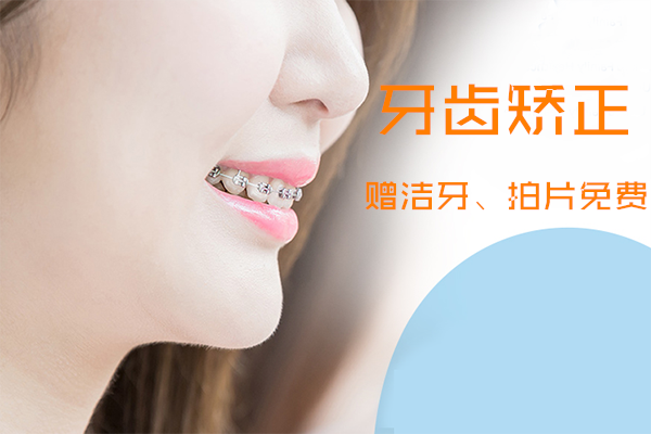 牙齿矫正