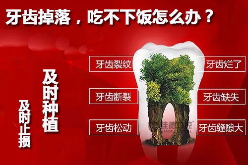 合肥植牙去哪好