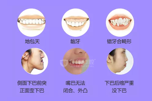 合肥矫正牙齿的好牙科