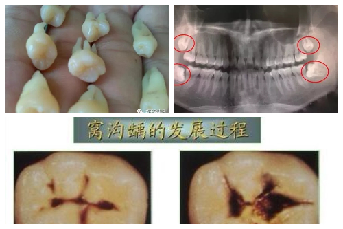 合肥口腔牙科收费表