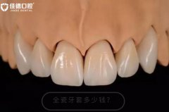 合肥全瓷牙套多少钱一颗-牙齿真能变好看吗？