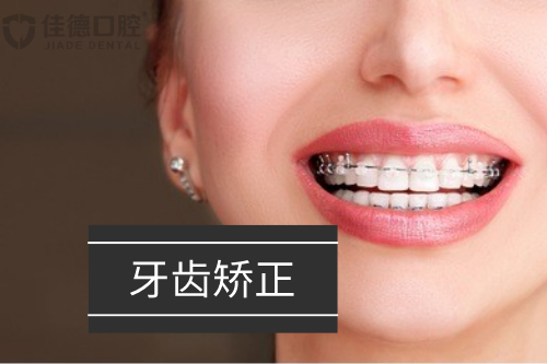 合肥矫正牙齿的正规医院