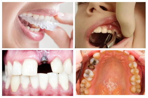 合肥口腔牙科排名