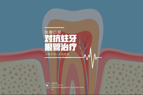 合肥根管的治疗