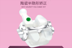 合肥隐形矫正牙齿多少钱-年末矫牙送福利？