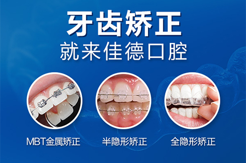 牙齿矫正
