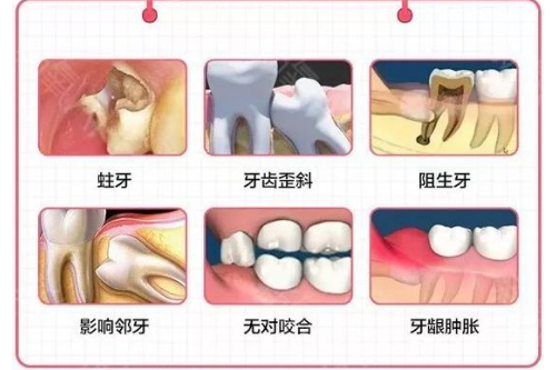 合肥口腔牙科拔牙收费