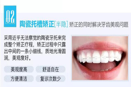 合肥整牙齿需要多少钱