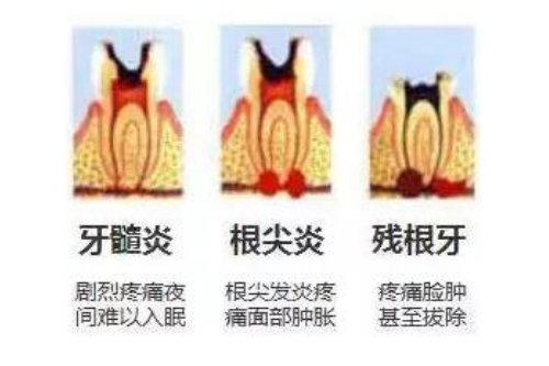 合肥拔牙到哪里拔好点