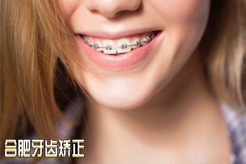 牙齿矫正
