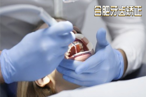 牙齿矫正