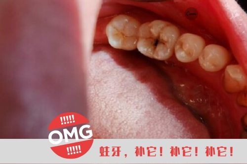 看牙