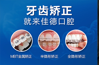 合肥牙齿矫正