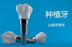合肥种植牙需要多少钱-限时优惠等你来！