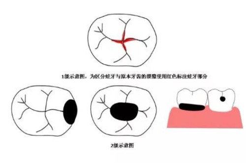 合肥的口腔牙科开门了吗?