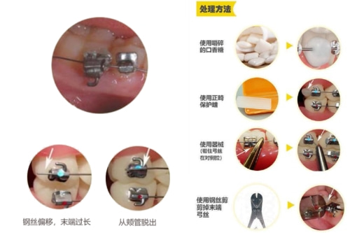 合肥的口腔牙科开门了吗？