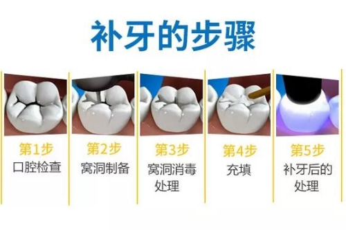 合肥补牙医院多少钱一颗