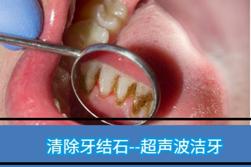 合肥的口腔牙科哪家好