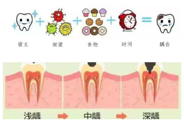 合肥补牙医院哪里比较好