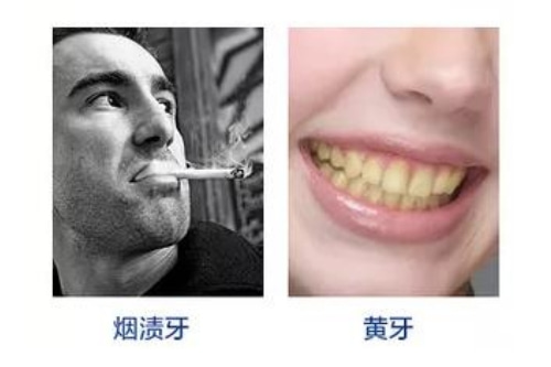 合肥的口腔牙科哪家好