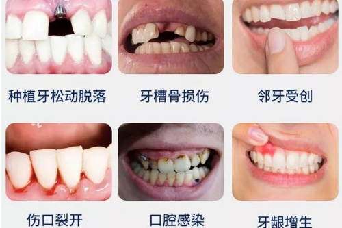 合肥市种植牙哪家比较好
