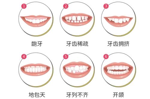合肥整牙多少钱