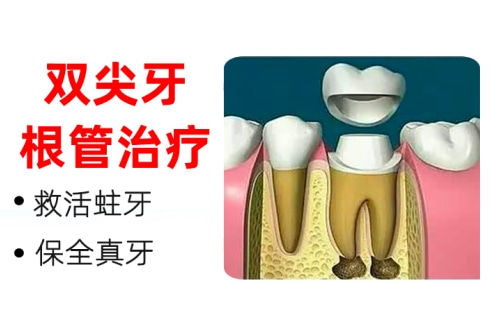 合肥根管治疗多少钱