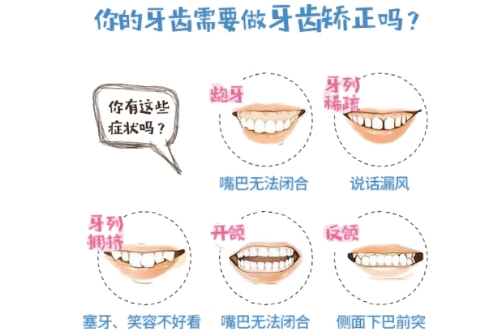 合肥牙齿矫正哪家好？