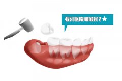 合肥弄牙齿哪个医院比较好-助您收获美牙！