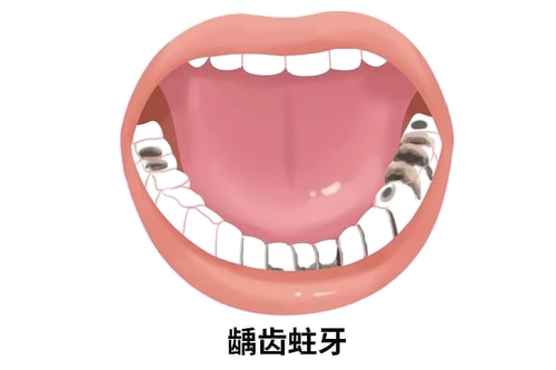 合肥弄牙齿哪个医院比较好