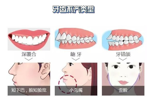 佳德口腔矫正费用、合肥牙齿矫正