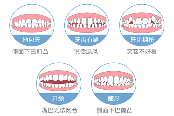 牙齿矫正