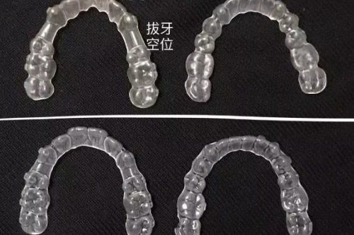 合肥比较好的整牙医院、佳德口腔