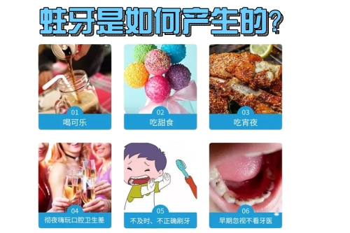 合肥补牙洞 佳德口腔蛀了牙补牙