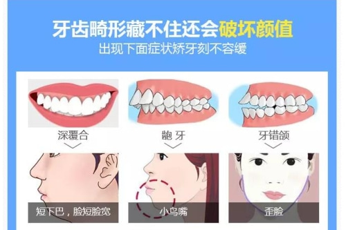 合肥矫正牙齿 牙齿矫正费用 佳德口腔整牙