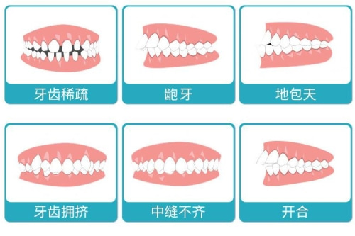 合肥矫正牙齿 牙齿矫正费用