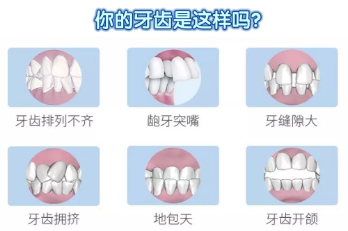 合肥矫正牙齿