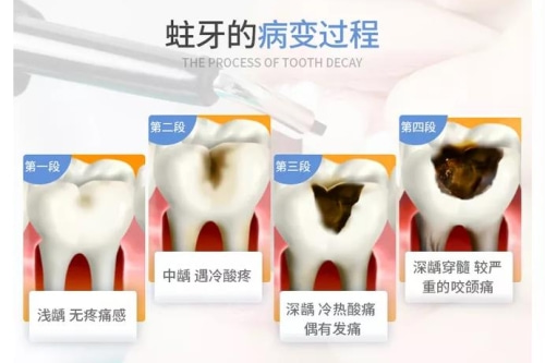 合肥正规牙科医院哪家好-私立优质牙科建议?