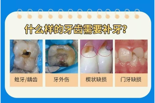 合肥的口腔牙科价格表、佳德口腔价格