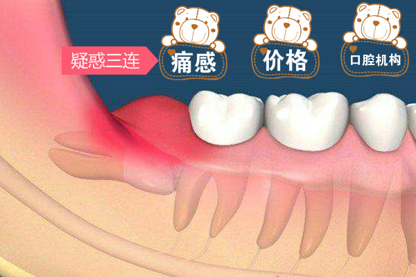 合肥拔智齿