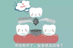 佳德口腔种植牙怎么样-这些细节可还行？