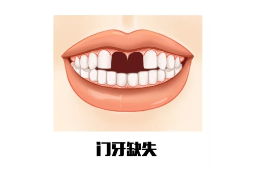 合肥种植牙齿哪家医院好