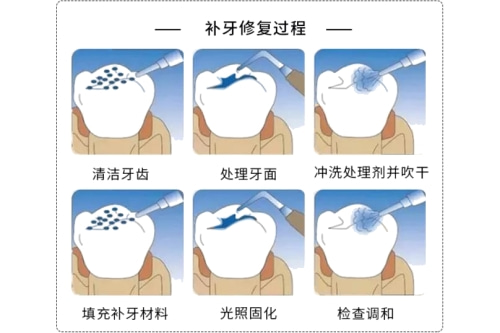 合肥补牙哪个医院实惠又好