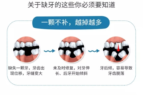 佳德口腔种植牙怎怎么样