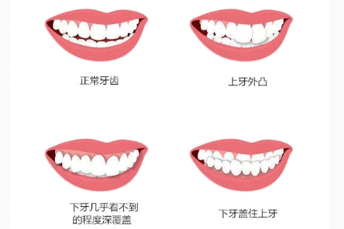 合肥矫正牙齿哪家好