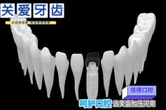 安徽佳德口腔-看牙找本土齿科