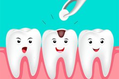 合肥补牙多少钱一颗？--救一救牙齿，刻不容缓